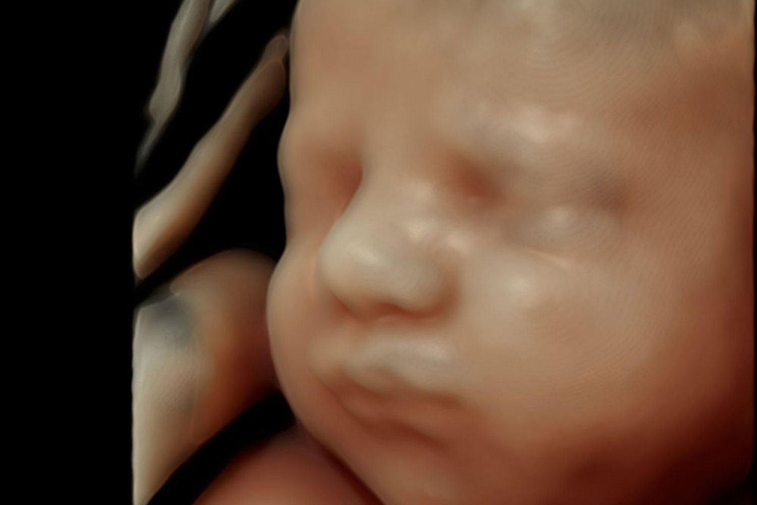 4Dエコー｜匠レディースクリニック