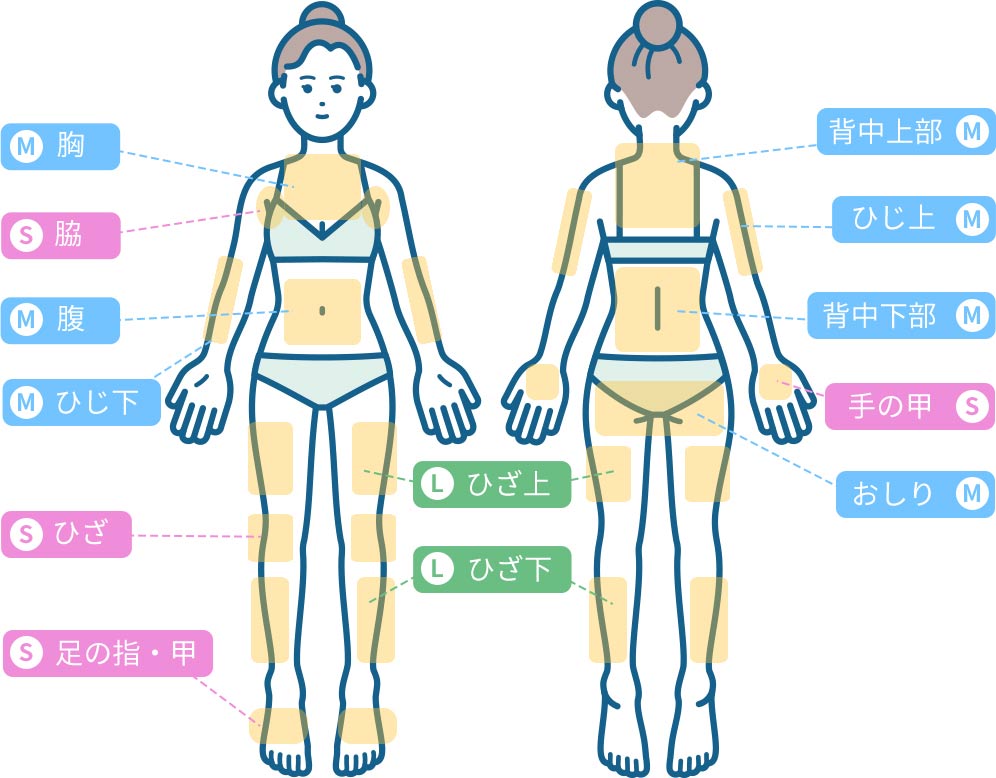 栃木県佐野市の医療脱毛でジェントルマックスプロプラスを導入している匠レディースクリニックの女性全身脱毛部位の説明図
